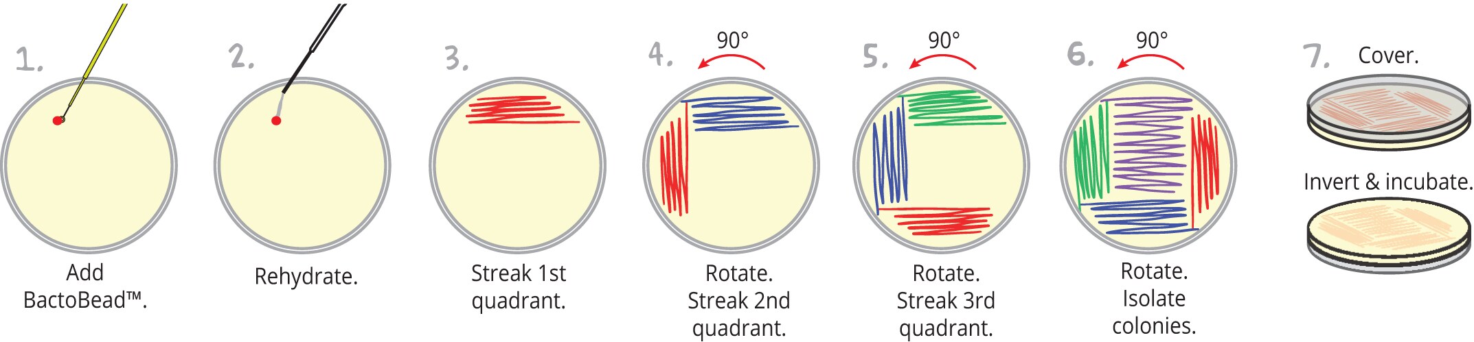 protein electrophoresis