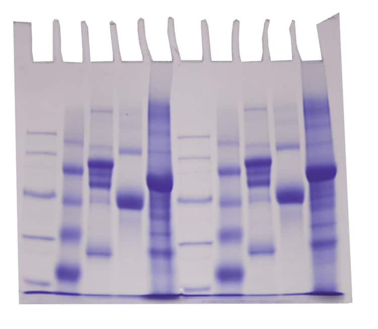 protein electrophoresis gel