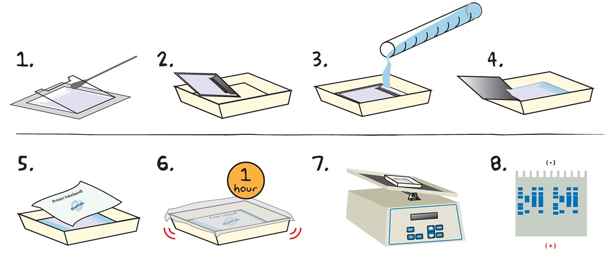 protein electrophoresis