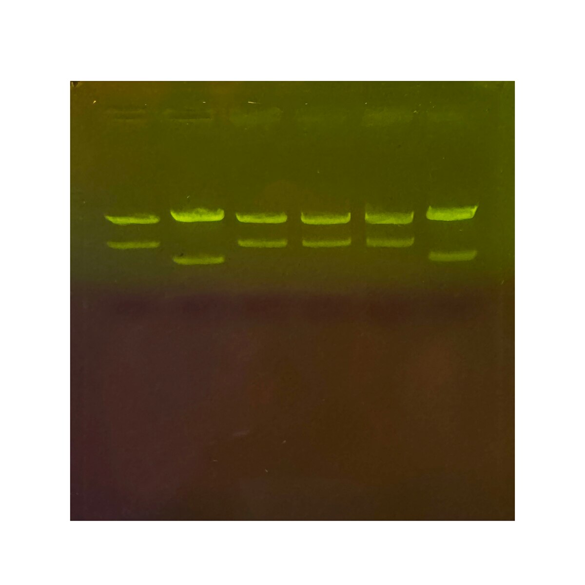 DNA Fingerprinting by Restriction Enzyme Patterns Kit |SYBR Safe