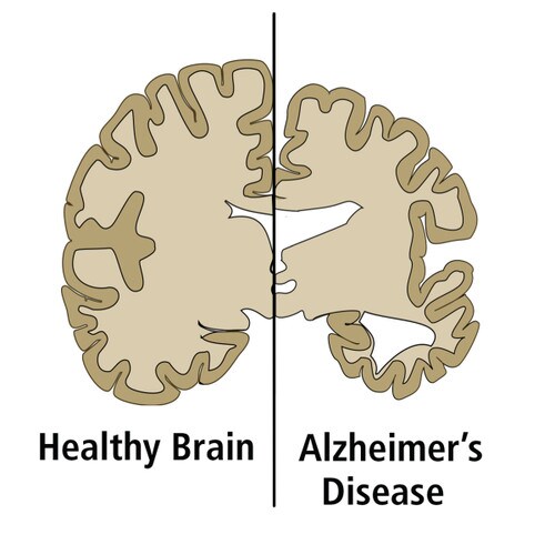 Alzheimer's Disease ELISA Kit | Neurobiology | EDVOTEK