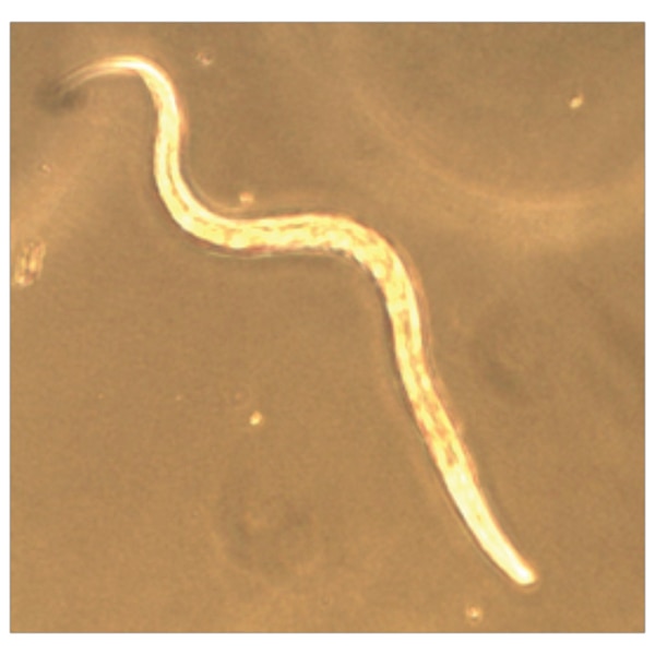 852 - Chemotaxis: The Science of Attraction in C. elegans